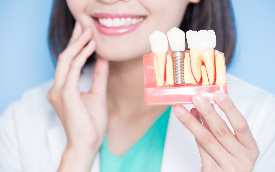 Implantat mit Knochenaufbau – Kosten und Vorteile