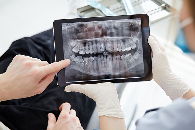 Patient und Zahnarzt betrachten gemeinsam eine Röntgen-Aufnahme auf einem Tablet